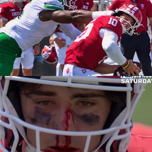 Indiana QB Josh Hoover Bloodied After Wild Facemask Hit in Terrifying Moment